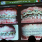 9月20日（月）　矯正治療と筋機能療法　講習会