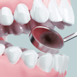 身元特定に重要な役割～警察歯科医って？～