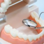 入れ歯は自分で調整してよいの？～入れ歯の不具合について～