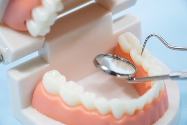 歯の模型 歯の模型